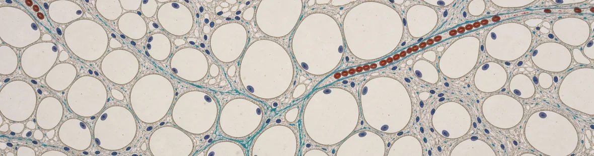 Microscope photograph of visceral fat tissue with pale irregular fat cells, fine turquoise connective tissue and a small red capillary